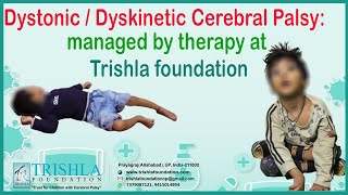 Dystonic  Dyskinetic Cerebral Palsy managed by therapy at trishla foundation [upl. by Wallinga]