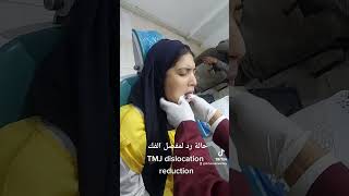 حالة رد لمفصل الفك TMJ dislocation reduction [upl. by Nessi]