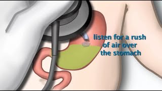 Otitis Media Anatomy Pathophysiology Risk Factors Types of OM Symptoms and Treatment Animation [upl. by Oca179]