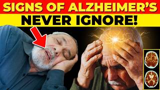 ALERT These are the EARLIEST Signs of Alzheimers DISEASE [upl. by Ferna615]