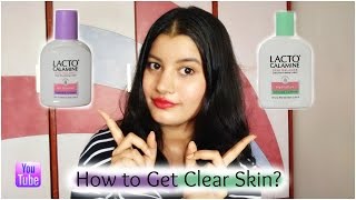 Get Clear Skin with Lacto Calamine Lotion  Remove Acne Scars amp Pigmentation Easily  Riya Beauty [upl. by Rainah]