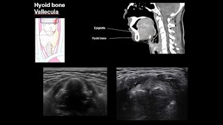 ENGNeck anatomy 1center [upl. by Yenttihw]