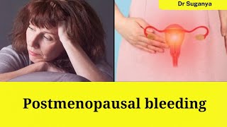 Postmenopausal bleeding in Tamil [upl. by Hrutkay]