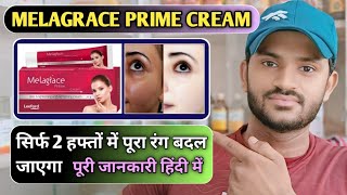 Melagrace prime cream use dose benefits and side effect Full review in hindi [upl. by Giule]