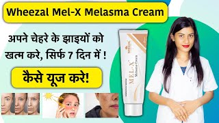 itch guard cream ke fayde  itch guard cream uses in hindi  itch guard plus cream benefits [upl. by Dalohcin]