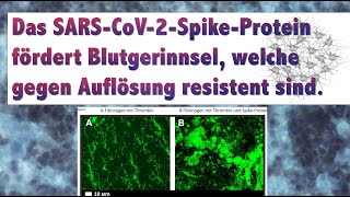 Gerinnselbildung „Clots“ durch SpikeProtein Reaktion auf Studie Blutgerinnung Thrombozyten Clots [upl. by Anabelle15]