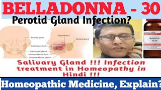 पेरोपैरोटिड ग्रंथि उपचार होम्योपैथी से What are the Salivary gland infection homeopathy treatment [upl. by Aelaza551]