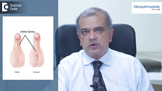 What is Hypospadias  hypospadias signs and symptoms  Dr CN Radhakrishnan  Manipal Hospitals [upl. by Elletsyrc]