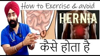 कैसे होता है हर्निया  How to Exercise to Avoid HERNIA  How to Cure  DrEducation Hindi [upl. by Ymer]