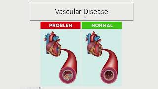 Understanding Scleroderma Vascular Biology [upl. by Atem]