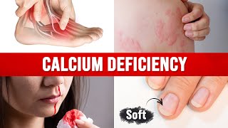 Best Home Test for a CALCIUM DEFICIENCY [upl. by Zacharias]