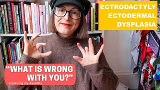 My Disability  EEC Syndrome  Ectodermal Dysplasia [upl. by Olbap303]