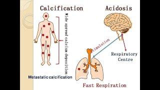 Acidosis alkalosis and calcification [upl. by Nirac]