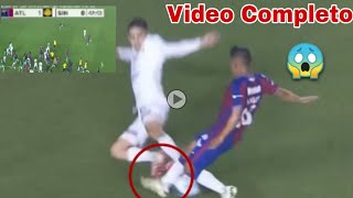 Video completo Lesión de Hobbit Bermúdez Atlante vs Dorados momento exacto [upl. by Sashenka969]