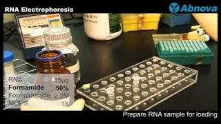 RNA Electrophoresis [upl. by Eisinger]