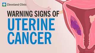 The Most Common Warning Sign of Uterine Cancer [upl. by Assirrem]