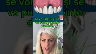 Implant versus puntea proteticacluj maradent dentist clujlife lifehacks implantdentarlife [upl. by Glaudia]