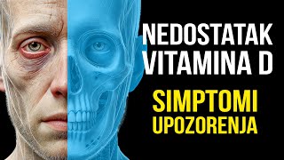 Simptomi Nedostatka Vitamina D  od Umora do Depresije [upl. by Suiramaj]