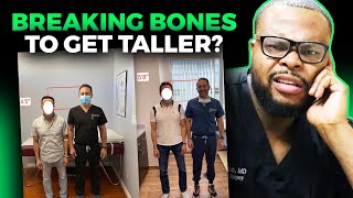 Orthopedic Surgeon Reacts  Breaking your Bones to Make you TALLER [upl. by Gladis270]