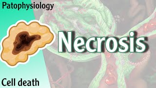 Pathophysiology  Necrosis cell death Hani Laith شرح [upl. by Lynna]