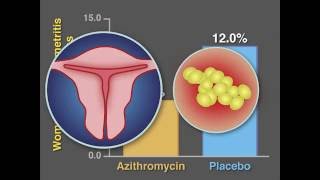 PostCesarean Infection and Antibiotic Prophylaxis  NEJM [upl. by Ilwain]