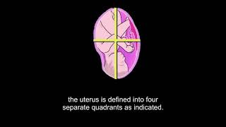 Ultrasound of amniotic fluid assessment and macrosomia Level 1 [upl. by Barby96]