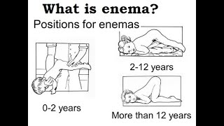 StepbyStep Guide Giving an Enema  Watch Video Demonstration  SV5 Healthcare [upl. by Hui]