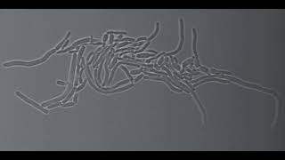 Multiple fission in Corynebacterium matruchotii [upl. by Niad]