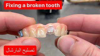 REPAIRING A CAST METAL PARTIAL DENTURE [upl. by Sherfield]