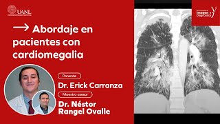 Abordaje en pacientes con cardiomegalia por el Dr Erick Carranza [upl. by Lusa266]