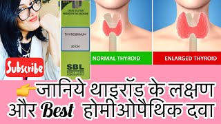 थाइरॉड का पक्का इलाजThyroidinum Homeopathic Medicine For Thyroid ProblemsDrRukmani Homeopath [upl. by Acinnod]