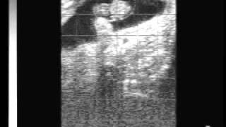 Bovine pregnancy 40 days with EasiScan ultrasoundwmv [upl. by Skoorb]