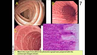 OSPE in Anatomy of Gastrointestinal and Renal Systems [upl. by Dawes]