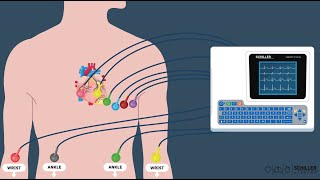 SCHILLER ECG Electrocardiogram Basics [upl. by Soni]