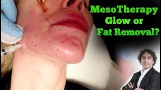 MesoTherapy How to Get Beautiful Skin [upl. by Yleve]