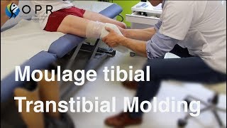 Moulage tibial pour la fabrication d’une prothèse à OPR BretagneNormandie [upl. by Sset]