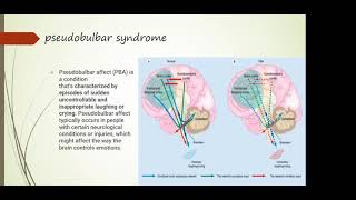 19 Bulbar and pseudobulbar syndrome topical and differential diagnostics [upl. by Stav]