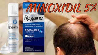 True Review  Rogaine Foam  Minoxidil [upl. by Anma]