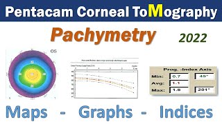 Pentacam Corneal ToMography  Pachymetry19 [upl. by Oznecniv]