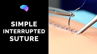 Simple interrupted suture wound suturing  OSCE Guide  UKMLA  CPSA [upl. by Elbring]