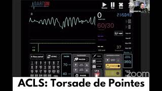 ACLS Torsade de Pointes 🚨 🫀 [upl. by Myrtice462]