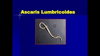 Ascaris lumbricoid in Amharic [upl. by Refitsirhc]