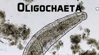 Howies Lab  Worm Oligochaeta [upl. by Battista]