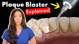 Dental Hygienist Explains Ultrasonic Scaling  Teeth Cleaning With Plaque Blaster [upl. by Llorre991]