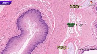 Histology of trachea  Shotgun Histology [upl. by Isbella846]