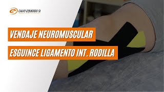 Vendaje neuromuscular para esguince del ligamento interno de rodilla [upl. by Birgitta]