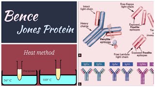 Bence jones protein  multiple myeloma  Methodspathologypathologylabbiochemistry bjp [upl. by Ahsietal]