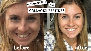 My Thoughts on Collagen Peptides  Benefits  Plus My Before and After [upl. by Anthe706]