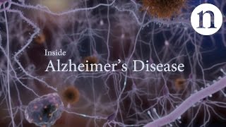 Inside Alzheimer’s disease [upl. by Corbie]