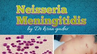 Microbiology lectureNeisseria Meningitidis  disease symptoms pathogenesisdiagnosis treatment [upl. by Mossberg]